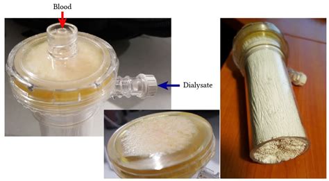 do dmso filters work